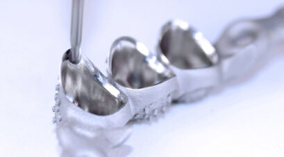 Möglicher Prozess für TempoPlant Fertigungszelle - Kugelkopffräser während der Fertigung einer patientenspezifischen Metall-Zahnleiste