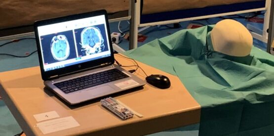 Beispielübungsplatz. CT Daten des Patienten (links) mit maßstabsgetreuem 3D Modell (rechts). Zur Markierung der Schnitte und Bohrungen werden Stifte verwendet. | Quelle: Bundeswehrkrankenhaus Westerstede