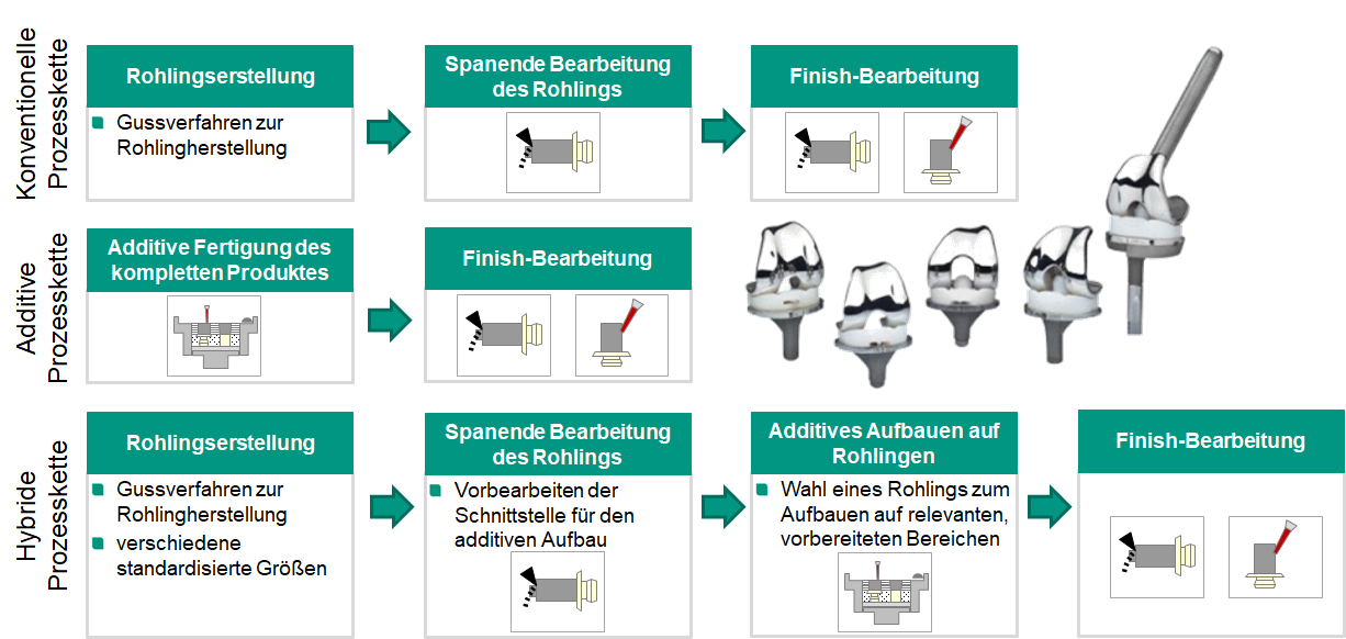 Schema der einzelnen Prozessketten zur Herstellung medizinischer Implantate | Quelle: wbk Karlsruhe, Alexander Jacob